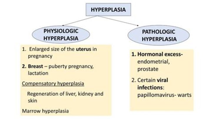 Can complex hyperplasia go away