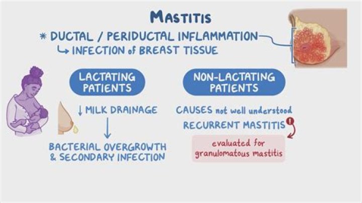 Can mastitis cause high fever