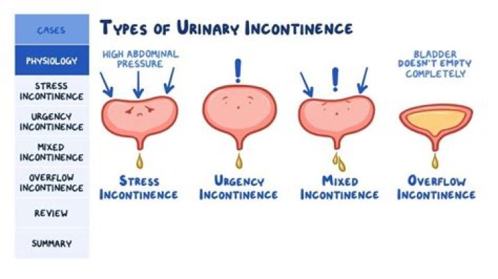 Does BPH cause incontinence