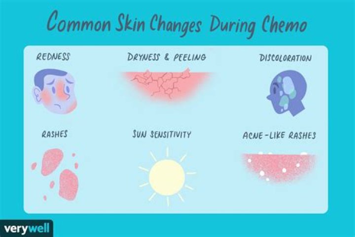 Does chemo cause skin discoloration