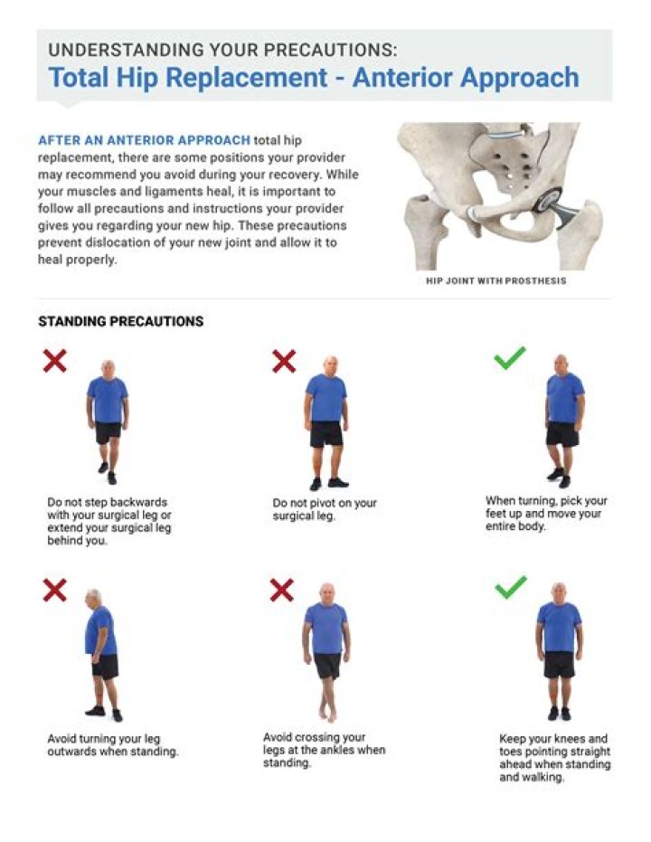 How do you reduce anterior hip dislocation