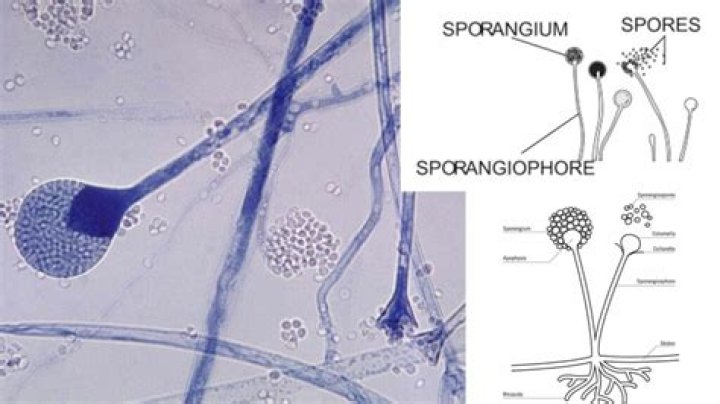 How does the annulus cause the Sporangium to open