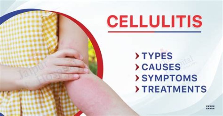 How would you describe cellulitis