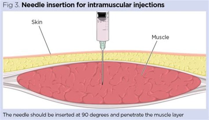 Is aspiration necessary when giving an IM injection