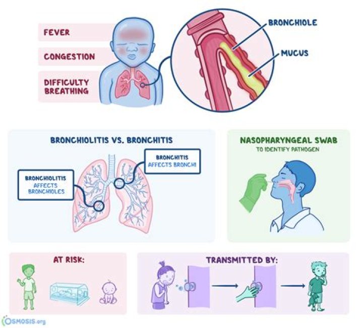 Is bronchiolitis viral or bacterial