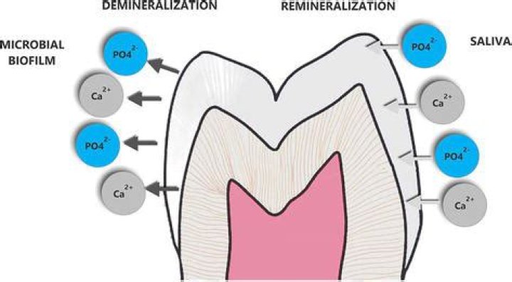 Is remineralization of teeth possible