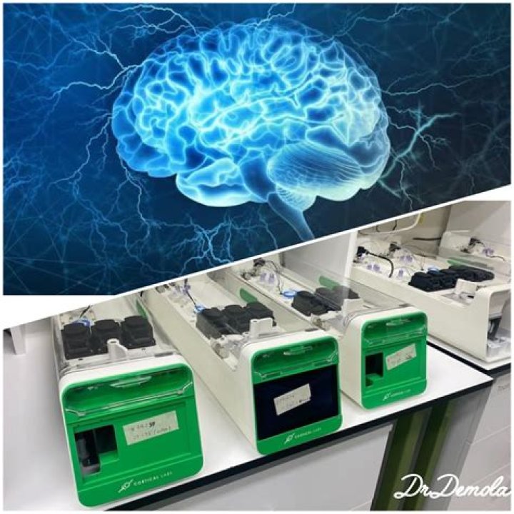 Is the brain a biological computer