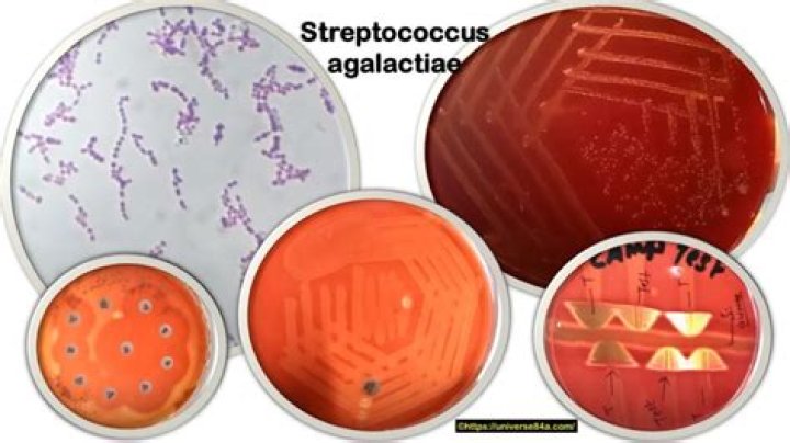 What antibiotic treats Streptococcus agalactiae