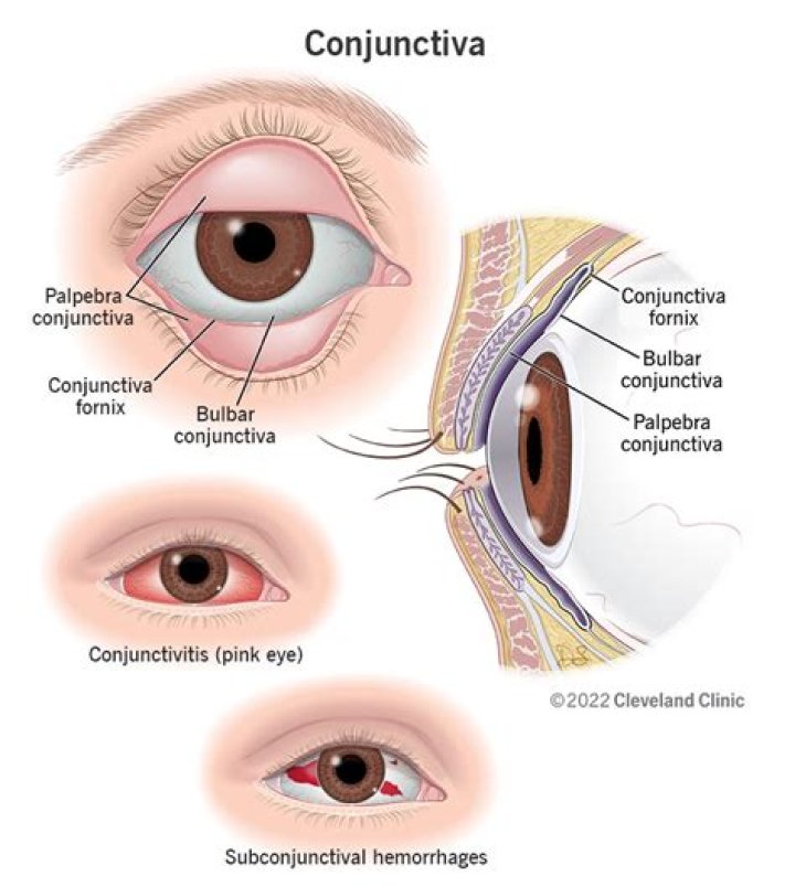 What are conjunctival papillae