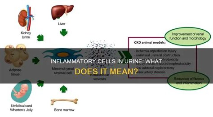 What are inflammatory cells in urine