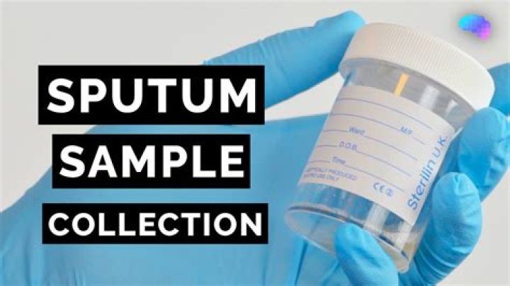 What can be found in a sputum sample