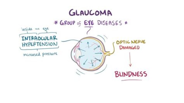 What chromosome is glaucoma found on