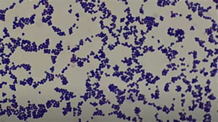 What disease does Streptococcus salivarius cause