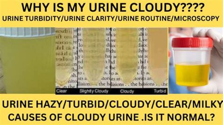 What does it mean if your urine is turbid