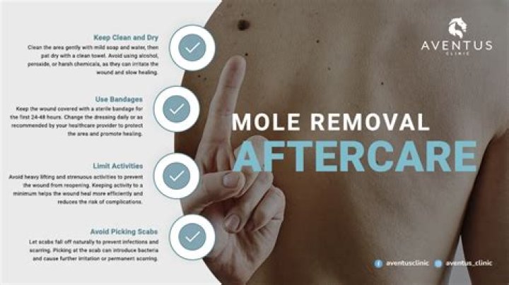 What happens if you pick a mole off