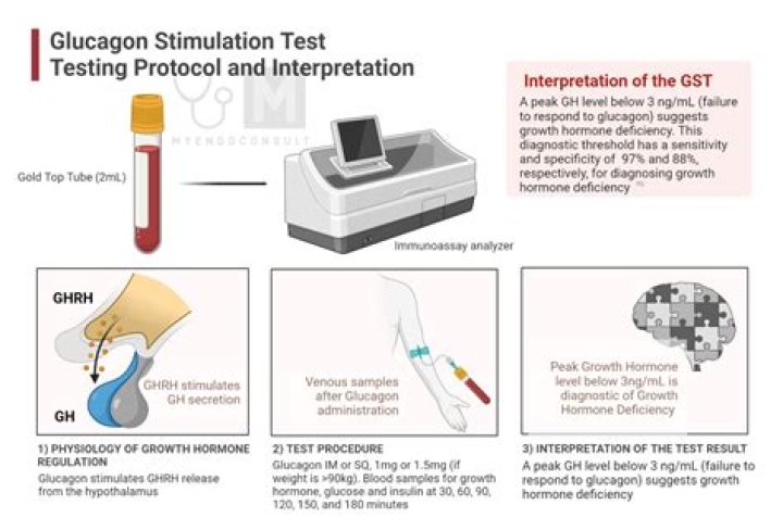What is a glucagon test
