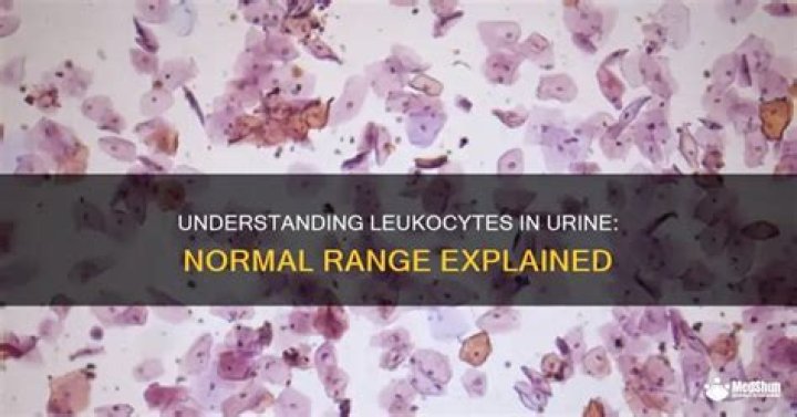 What is a high level of leukocytes in the urine