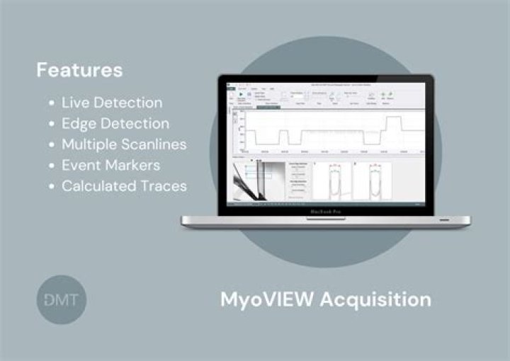 What is a myoview scan