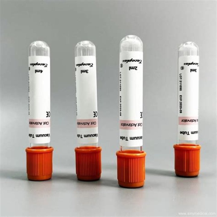 What is a serum sodium test