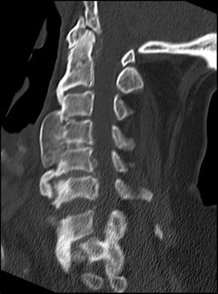 What is Dish radiology