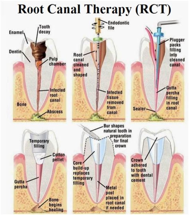 What is Endo anatomy