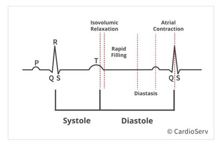 What is occurring during diastole