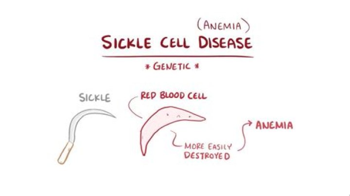 What is the definition of sickle cell