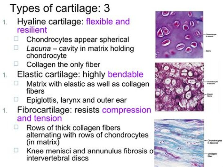 What is the most common cartilage