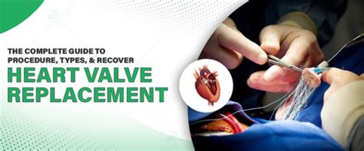 What is the procedure of mitral valve replacement
