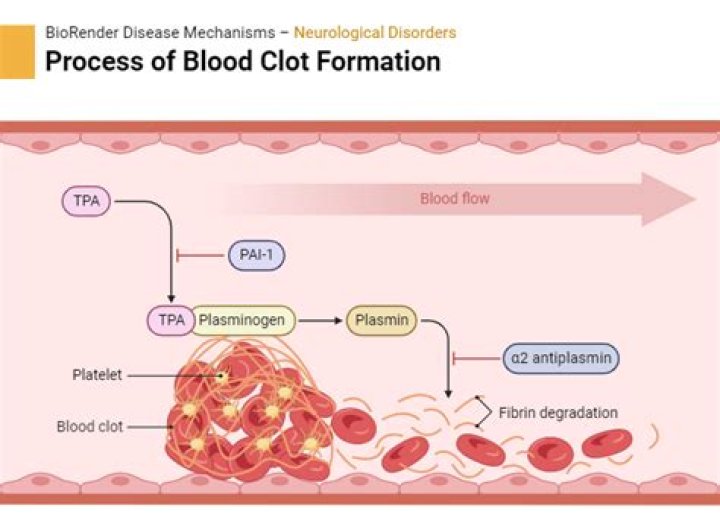 What is the process of dissolving an unnecessary blood clot