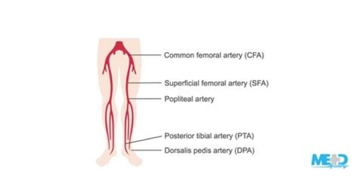 What is the SFA artery