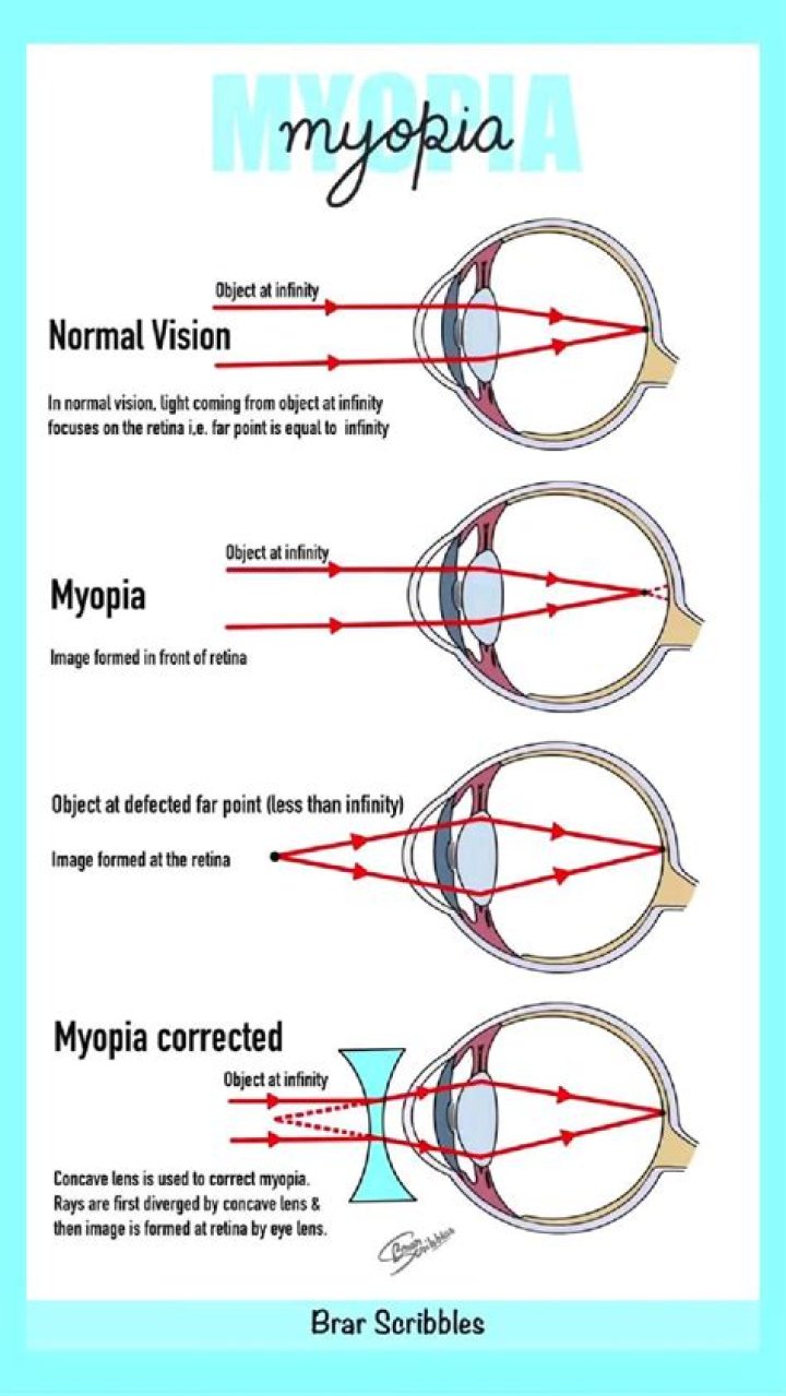 What is the term for any condition of abnormal development often with muscle degeneration