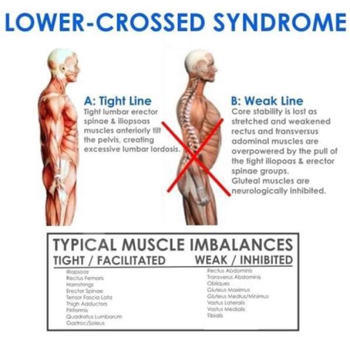 What muscles are lengthened in lower crossed syndrome