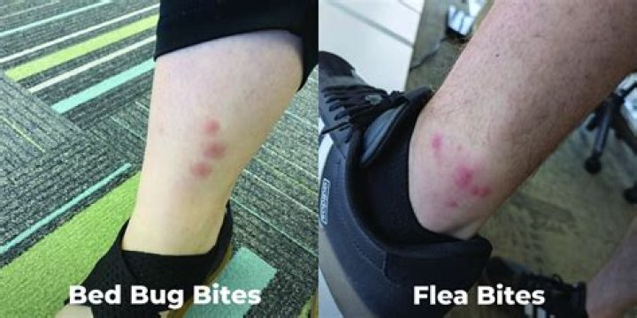 What other bug bites look like bed bug bites