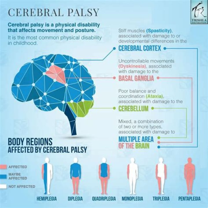What part of the brain is affected by cerebral palsy