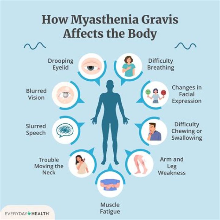 What symptoms would you expect with myasthenia gravis