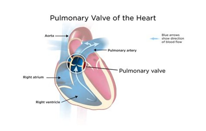 What would happen if the pulmonary valve did not close correctly