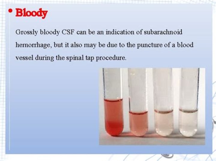 Where does the CSF mix with blood