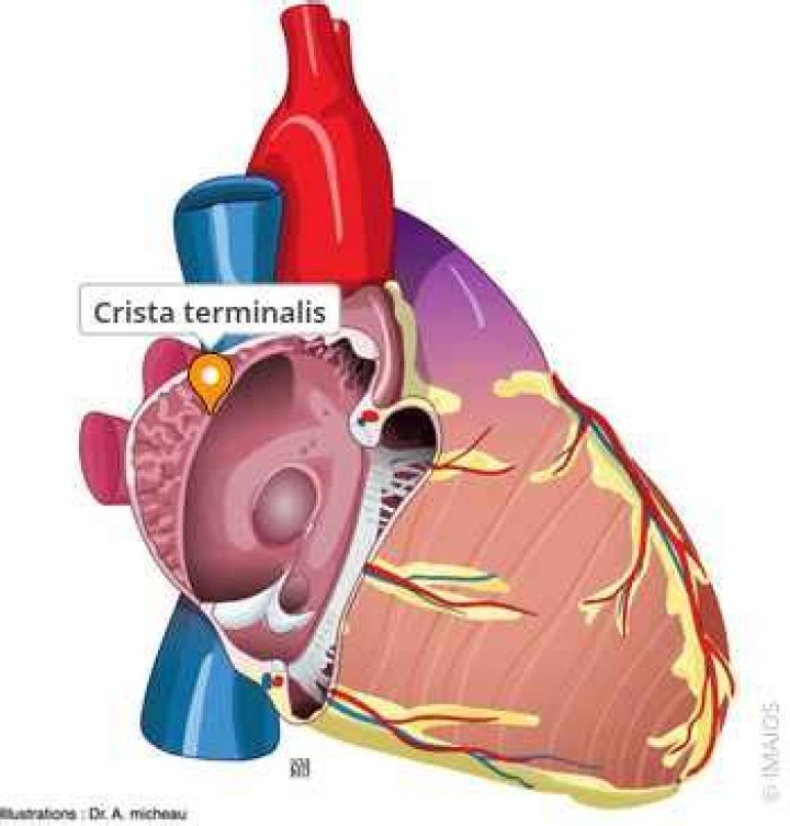 Where is Crista terminalis located