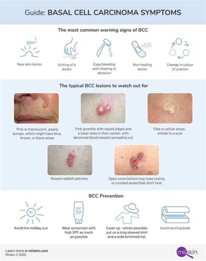 Which is worse basal cell or squamous cell cancer