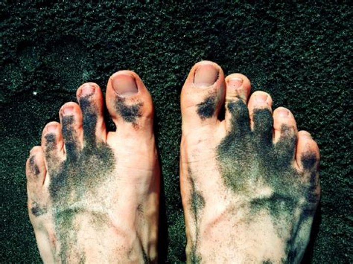 Why do I find feet disgusting