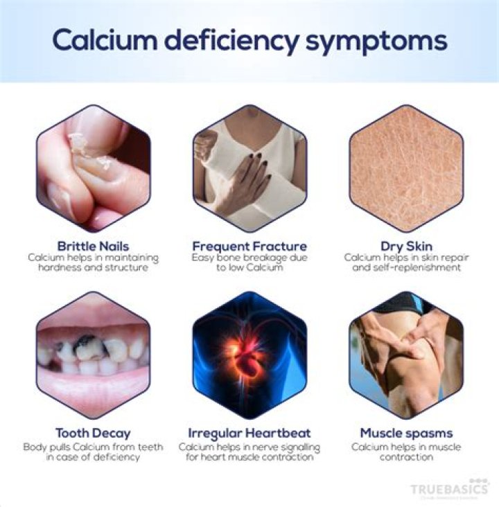 Will taking calcium help my teeth